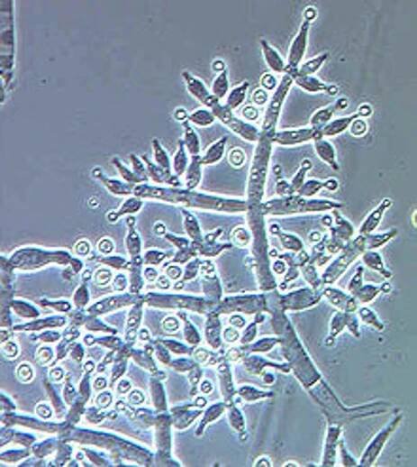 Trichoderma – Wikipedia