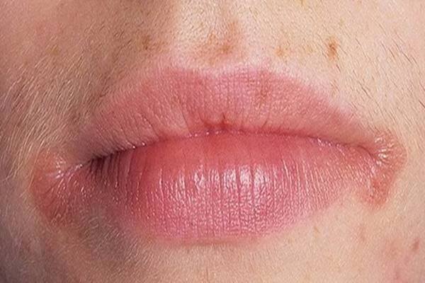 Pokud si všimnete jednoho z těchto častých příznaků, ihned kontaktujte lékaře. 97 % lidí chybně reaguje, až když už je příliš pozdě