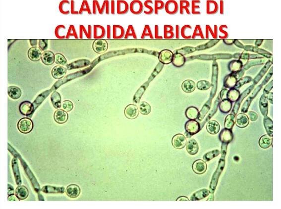 Micosi cutanea