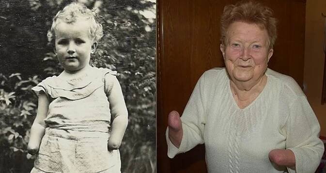Zemřela Anna Váchalová (†92): Matka jí uřízla obě ruce!