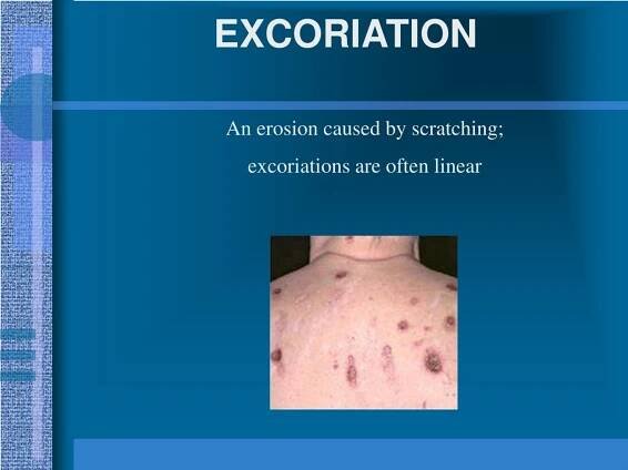 PPT - DERMATOLOGY PowerPoint Presentation, free download - ID:333669