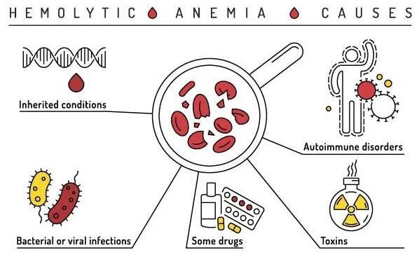 způsobuje hemolytickou anémii. užitečná infografika. vektorová ilustrace. - talasémie stock ilustrace
