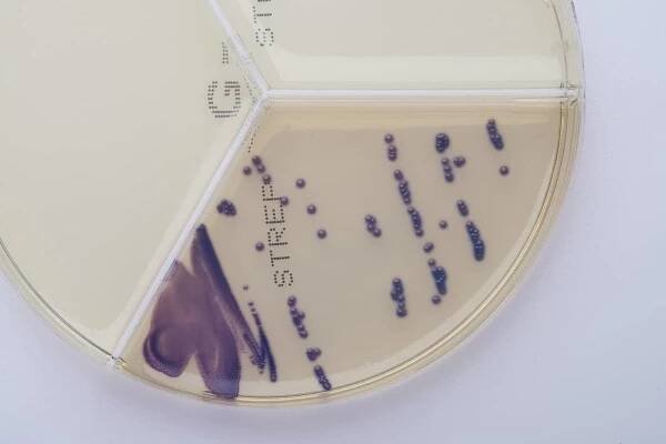 Streptococcus parauberis