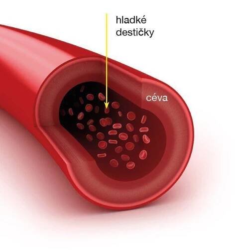 céva