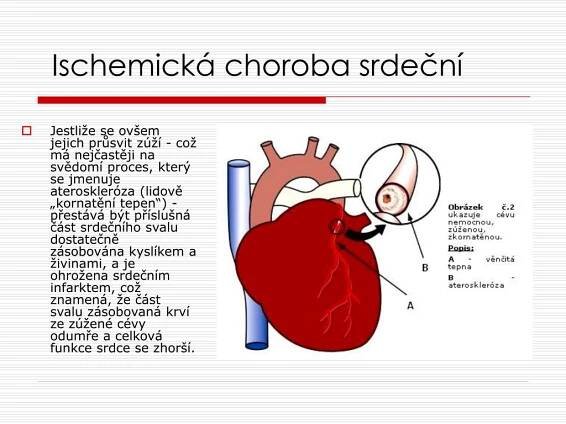 PPT - Operace srdce PowerPoint Presentation, free download - ID:6362872