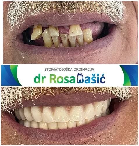 Before & After - Dental Office Dr Rosa Bašić