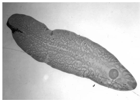 FIGURE 2. Juvenile Fasciola removed from the skin of the patient and stained with acid carmine. 
