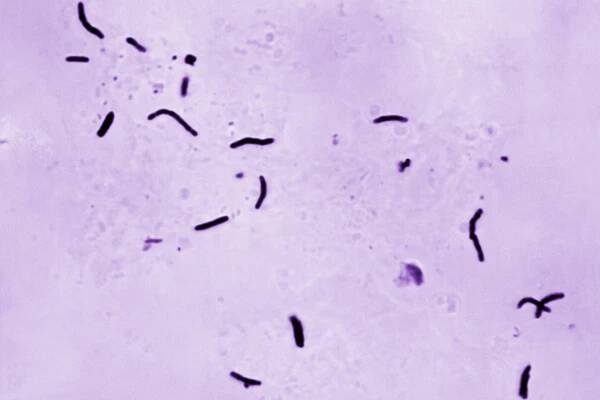 This 1966 microscope photo provided by the U.S. Centers for Disease Control and Prevention shows Mycobacterium tuberculosis bacilli.