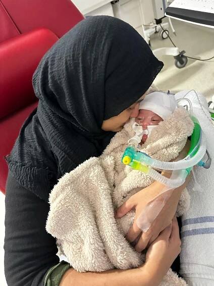 A mother holding her baby son, who is connected to a ventilator.