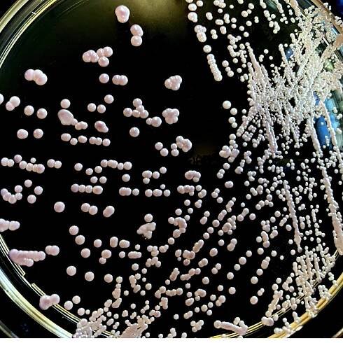 Candida Overgrowth
