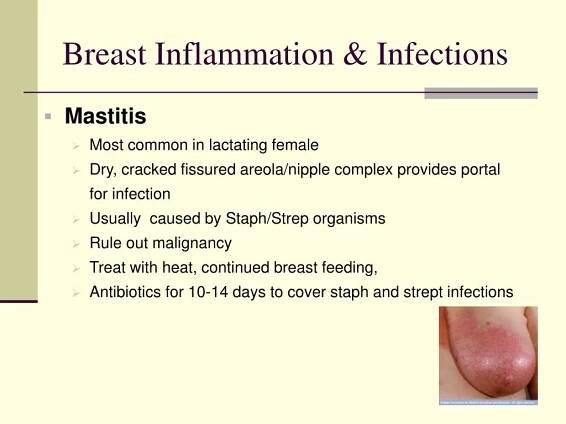 PPT - Benign Breast Problems PowerPoint Presentation, free download - ID:214729