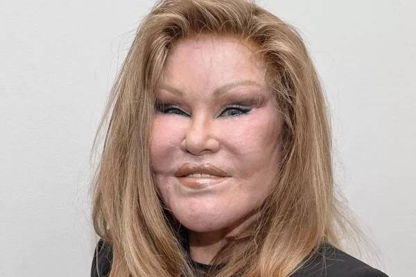 Jocelyn Wildenstein