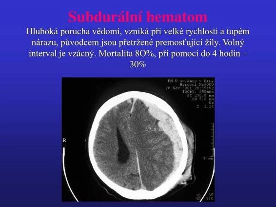 PPT - Úrazy hlavy, krku, páteře a pánve PowerPoint Presentation, free download - ID:5061452