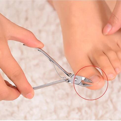 Nail clippers (47 fotografií): pinzeta na manikúru pro zarůstající nehty Mertz