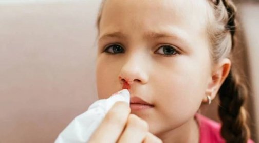 Krev z nosu u dětí: Proč k tomu dochází a jak správně zasáhnout