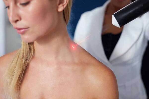 lokalizovaná kryoterapie na krku - cryotherapy - stock snímky, obrázky a fotky