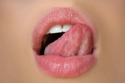 Uměle rudé rty. Sexy ženy otevřít ústa, lízání, jazyk vyčnívat. — Stock obrázek