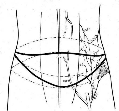 Rekonstrukce prsu po masektomii | Plastická a estetická chirurgie - Luboš Dražan