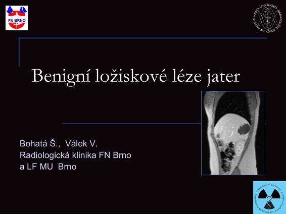 Benigní ložiskové léze jater