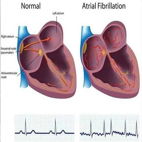 Pemeriksaan EKG - RS Jantung Binawaluya