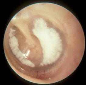 Name That Ear Finding!