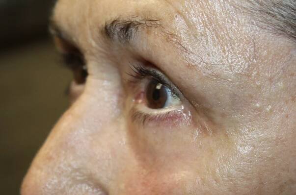 Leon Rafailov, MD - SightMD