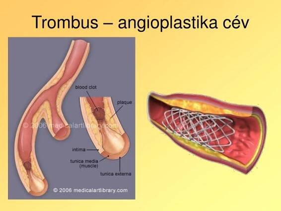 PPT - OBĚHOVÁ SOUSTAVA PowerPoint Presentation, free download - ID:5062732