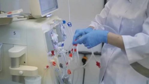 Hemodialýza, Umělý ledvinový aparát. Záchrana života. — Stock video