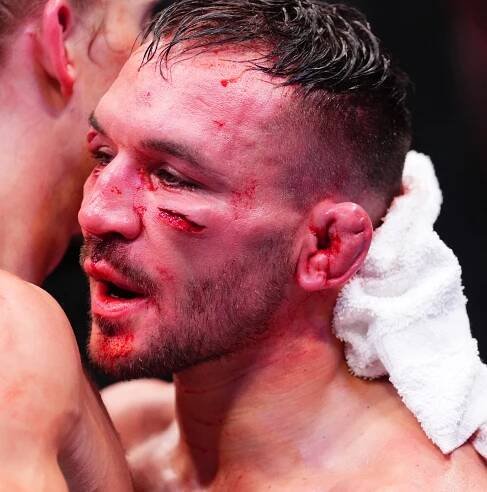 Michael Chandler suspended following Paddy Pimblett loss at UFC 314