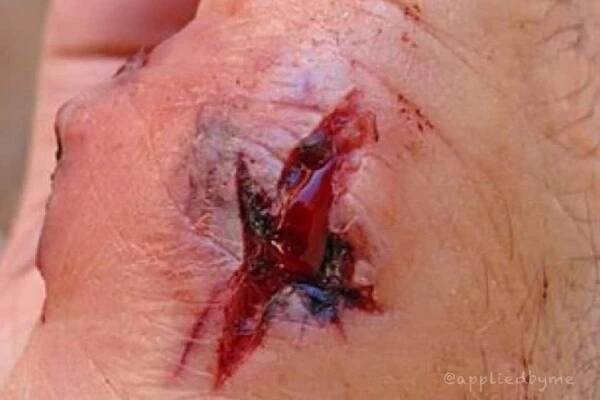 exitwound