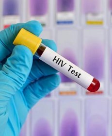 Namístě je podstupovat také test na HIV
