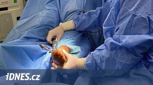 Ortopedi z jihlavské nemocnice ukazují lékařům, jak lépe operovat vbočené palce - iDNES.cz