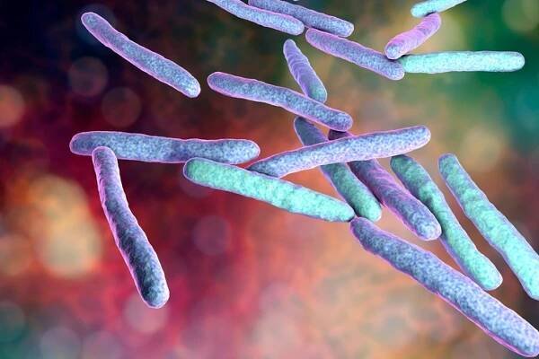 Mycobacterium Avium Complex (MAC)