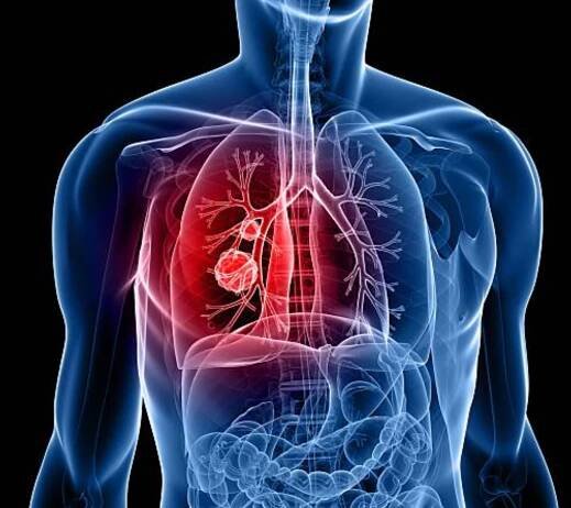 Covid Variant Symptoms: This COVID variant can infect the lower lungs and cause severe disease symptoms