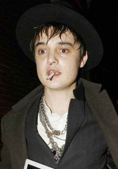 Kvůli drogám málem přišel o nohy: Takhle to chodí, když vám dojdou žíly, přiznává někdejší bouřlivák Pete Doherty