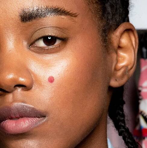Here's Exactly How to Get Rid of a Pimple Overnight
