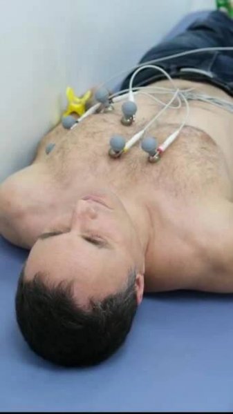Problém dělat kardiogram pro muže s chlupatou hrudí přilepení přísavky na hrudník zmizí nemožné, aby kardiogram provedení zkoušky nepohodlné technologické zařízení. Vysoká kvalita — Stock záběr