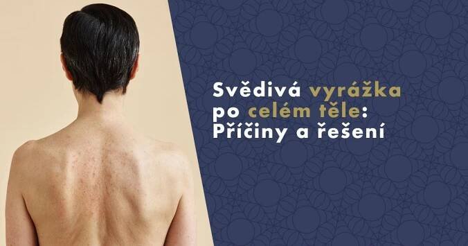 Svědivá vyrážka po celém těle: Příčiny a řešení