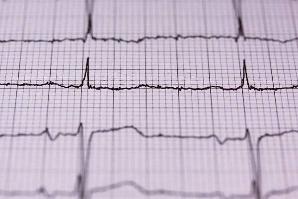 Ischemická choroba srdeční (ICHS): příčiny, symptomy a možnosti léčby