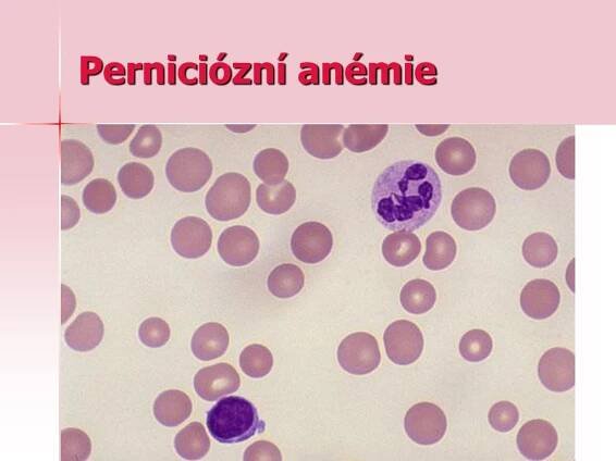 PPT - Patofyziologie krvetvorby PowerPoint Presentation, free download - ID:5328389