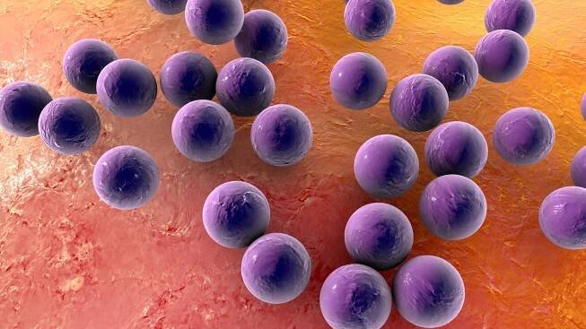Staphylokokken (Staphylococcus)