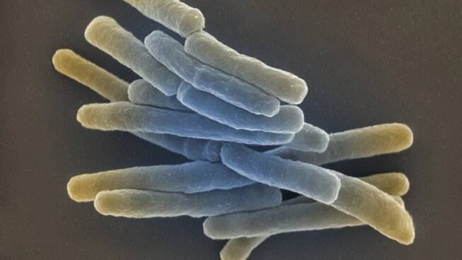 Mycobacterium tuberculosis. Längsschnitt. Elektronenmikroskopie. Bar = 1 µm. (© RKI)
