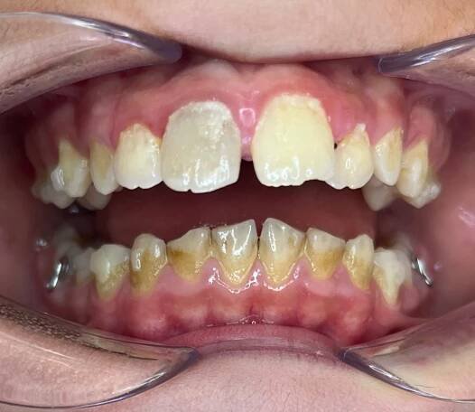DENTÁLNÍ HYGIENA | Ortodoncie MUDr. Hana Benešová 