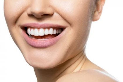 Zubní korunky mohou skutečně být k nerozeznání od okolních zubů - WomanOnly