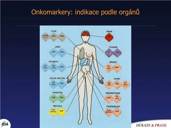PPT - ONKOMARKERY maj í význam v ambulantn í praxi ? PowerPoint Presentation - ID:890237