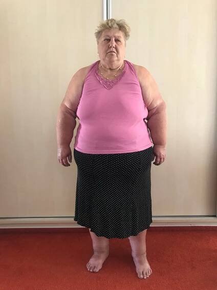 Paní Květoslava 65 let, zhubla 22 kg za 6 měsíců | Bc. Martina Jandová