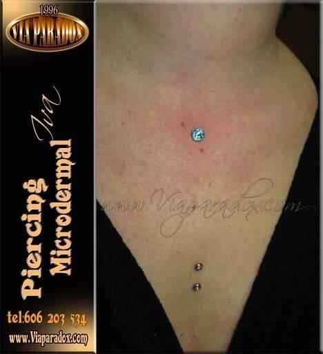 Microdermal - Via Paradox