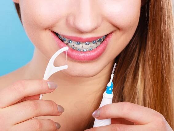 Flossing with Braces Made Easy!