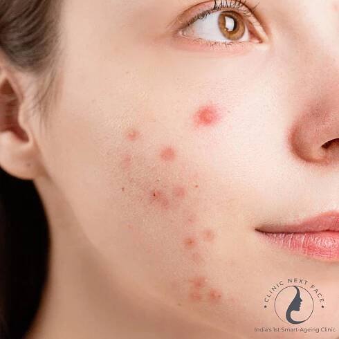What Makes CNF The Best Skin Specialist In Jp Nagar, Bangalore? 4
