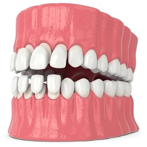 3D vykreslení čelistí s vyššími a spodními dýky — Stock obrázek